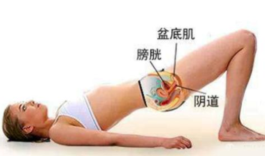 如何自我治疗子宫脱垂的方法及注意事项