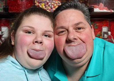 潜阳封髓丹加味治疗舌下肿疱医案案例