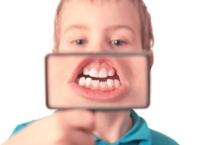 潜阳封髓丹加味治疗唇疮医案案例