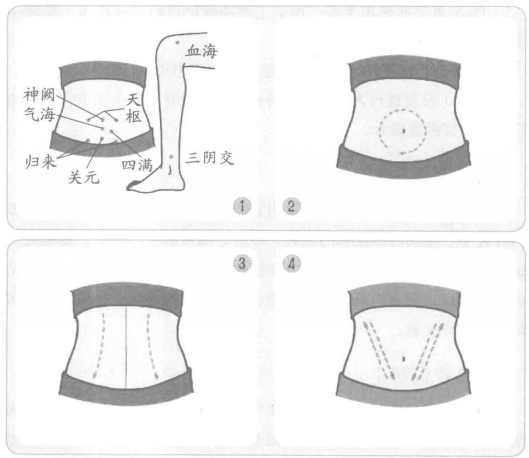 子宫肌瘤推拿按摩疗法_子宫肌瘤按摩哪些穴位好（图解）