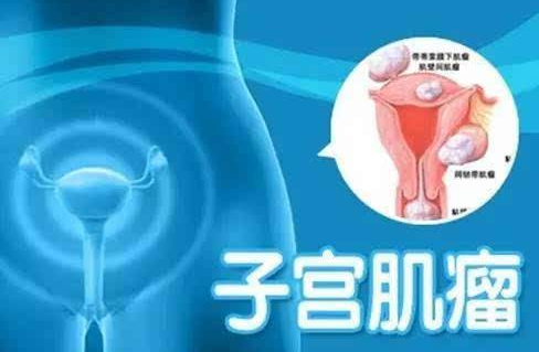 患子宫肌瘤时子宫内膜有何改变？