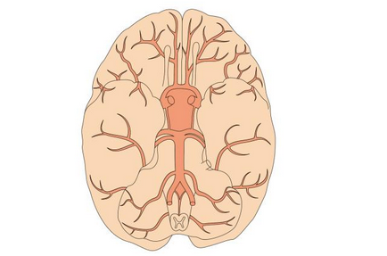 脑血管疾病患者如何保健养生？饮食及日常生活注意事项