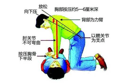 高血压导致心肌梗死的原因、表现症状与处理措施