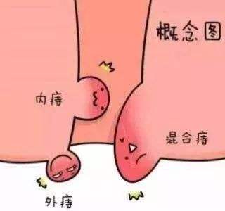 阴挺中药熏蒸治疗效果好吗？熏洗疗法中药方与注意事项