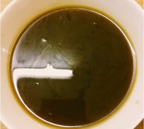 徐玉华补心益肾汤治疗心绞痛医案