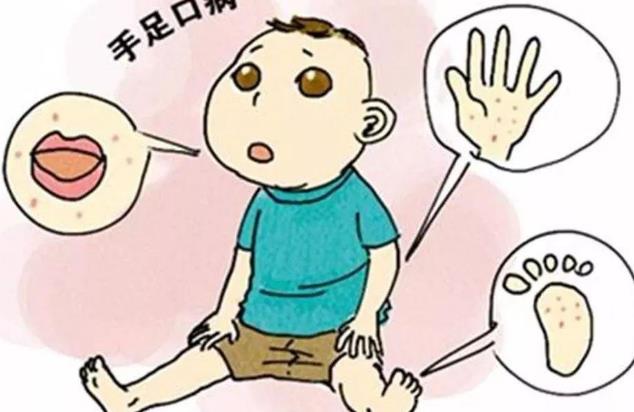 银翘马勃散加减治疗小儿手足口病效果与方法、经验