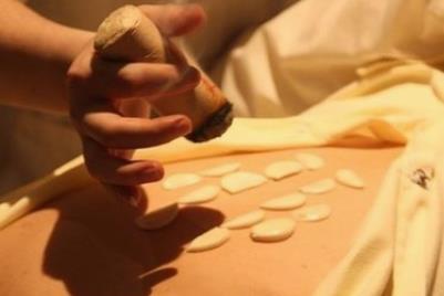 子宫脱垂艾灸哪里效果最好？艾灸治疗穴位与方法