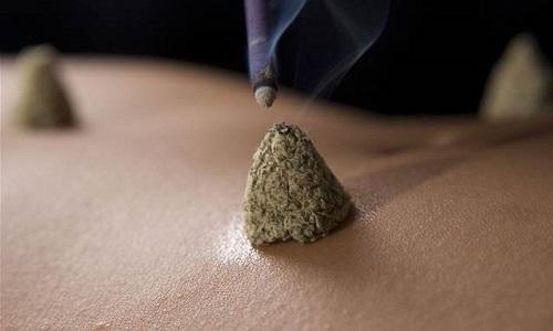 高血压艾灸有用吗？艾灸怎么调理？灸那几个部位？