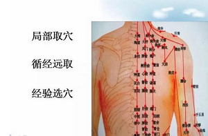 气脱证针灸治疗处方与部位方法_针刺哪里穴位效果最好