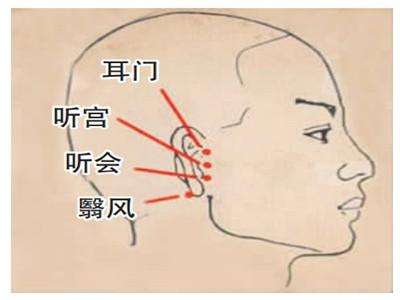 耳门穴的准确位置图和作用_位置怎么找?常用配伍与功效