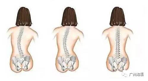 郭子光椎管狭窄眩晕方的配方组成、作用与功效、适应症