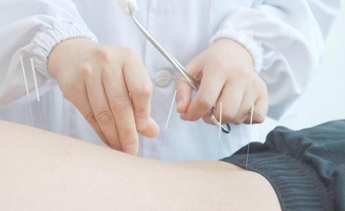 穴位埋线法治疗高血压穴位、方法、经典案例