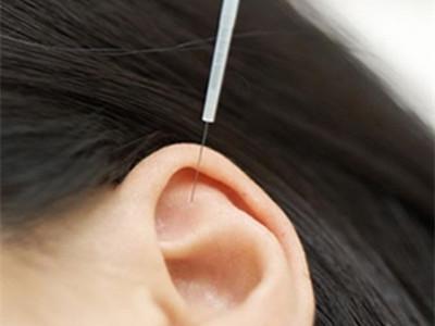 耳穴压丸法治疗习惯性便秘配方、医案、经典案例