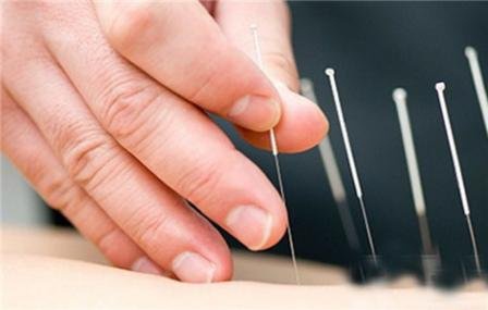 反阿是穴治疗腕关节扭伤配方、医案、经典案例