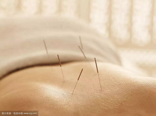 梅花针叩刺治疗胸胁软组织急性损伤配方、医案、经典案例