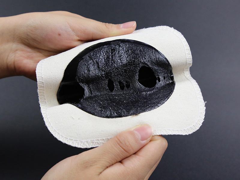 自拟消肿止痛散外敷治疗踝关节外侧副韧带扭伤配方、医案、经典案例