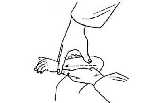 推拿法治疗小儿便秘配方、医案、经典案例