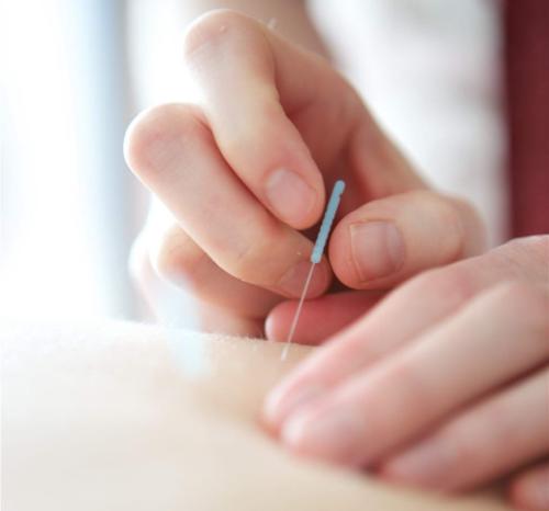 推拿配合针刺法治疗小儿便秘配方、医案、经典案例