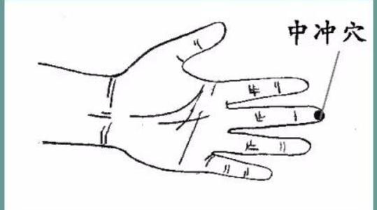 针刺中冲穴治疗小儿夜啼配方、医案、经典案例