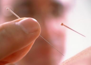 针刺法治疗小儿脱肛配方、医案、经典案例