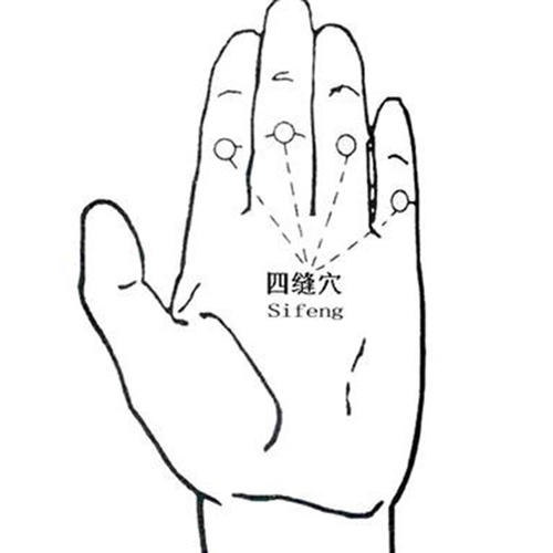 针刺配合中药外敷治疗小儿荨麻疹配方、医案、经典案例