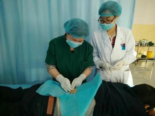 电针治疗1治疗痔疮配方、医案、经典案例