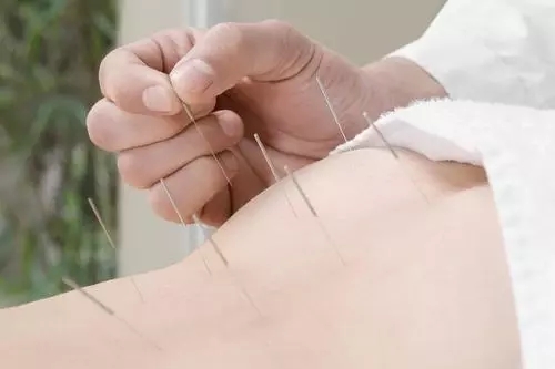 挑治配合针刺二白穴治疗痔疮配方、医案、经典案例