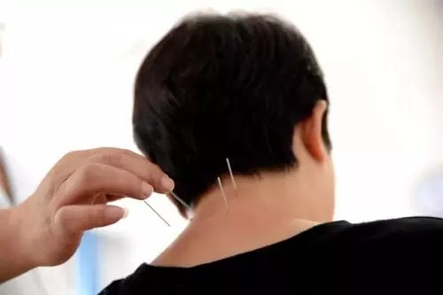 小针刀疗法治疗痔疮配方、医案、经典案例