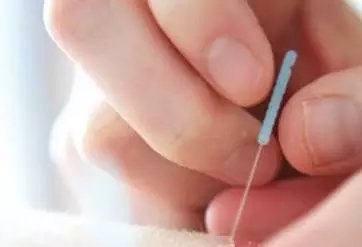 刺络放血法治疗痛风性关节炎方法、医案、经典案例