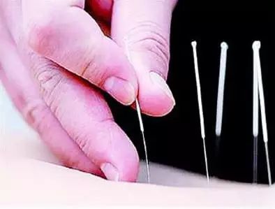 梅花针叩刺法治疗痛风性关节炎方法、医案、经典案例