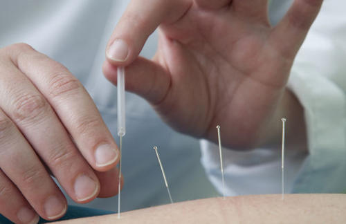 梅花针法治疗中风后偏瘫配方、医案、经典案例