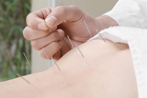 头针配合穴位注射治疗中风后视觉障碍配方、医案、经典案例