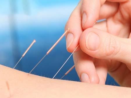 耳针配合针灸治疗痛经治疗崩漏配方、医案、经典案例