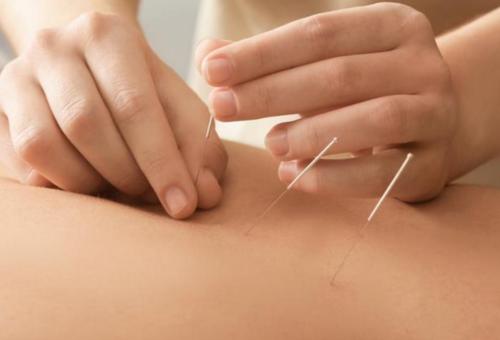 针刺推拿法治疗痛经伴不孕医案、经典案例