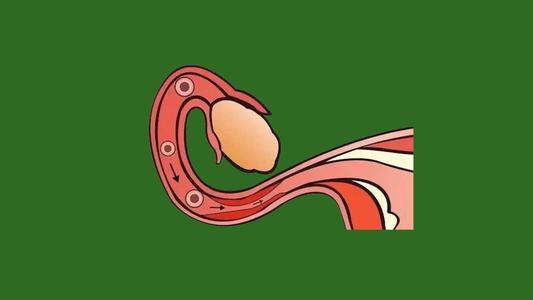 针刺结合归肾丸治疗男性免疫性不育症医案、经典案例