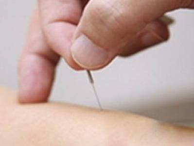 针刺配合药物治疗酒渣鼻配方、医案、经典案例