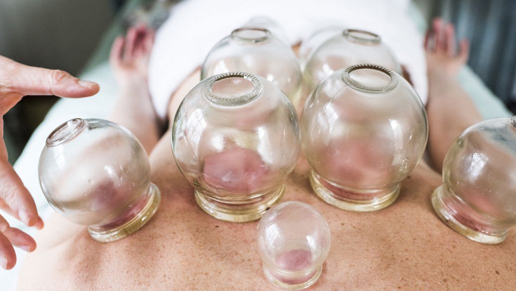 刺络拔罐法治疗酒渣鼻配方、医案、经典案例