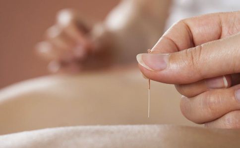 加减四物汤与梅花针叩刺治疗脱发配方、医案、经典案例