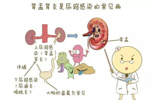 乌梅丸加减治泌尿系感染医案、配方