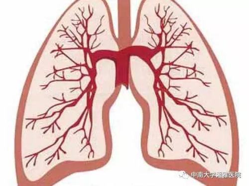 防风通圣散加减治肺胀医案、配方