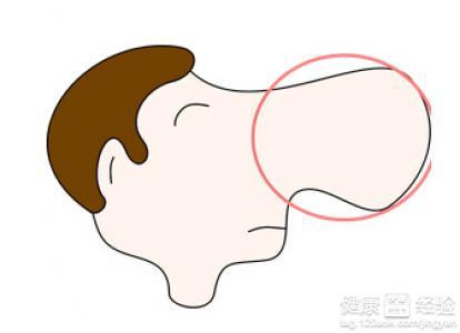 防风通圣散加减治酒渣鼻医案、配方