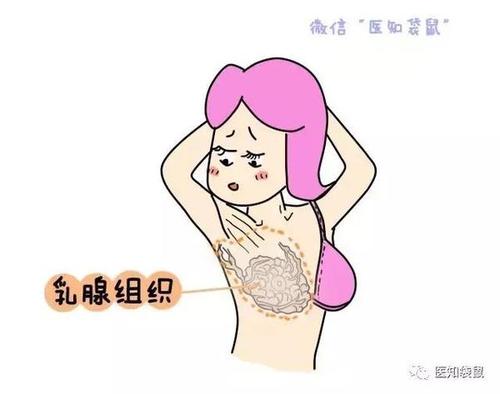 防风通圣散加减治碰撞乳房后带下量多医案、配方