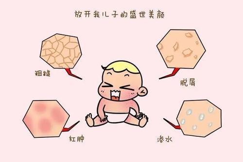 参苓白术散加减治小儿湿疹医案、配方