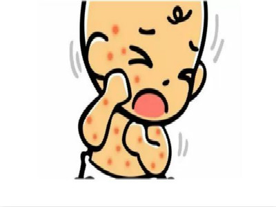 补中益气汤加减治小儿过敏性紫癜医案、配方