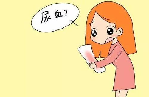 补中益气汤加减治尿血医案、配方