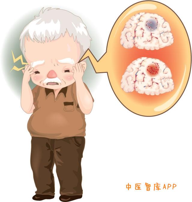 白虎汤加减治脑出血医案、配方