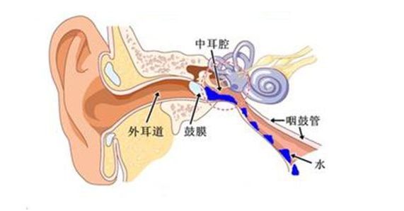 血府逐瘀汤加减治急性卡他性中耳炎医案、配方