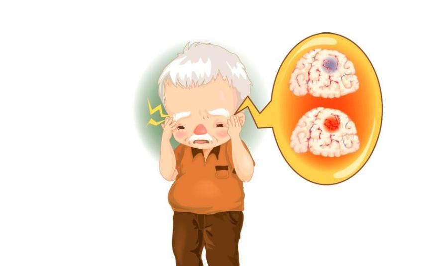 血府逐瘀汤加减治脑血栓形成医案、配方