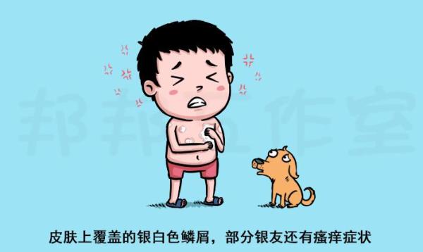 血府逐瘀汤加减治银屑病医案、配方