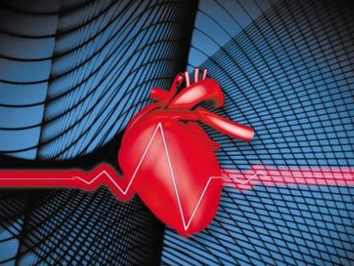 桂枝汤加减治室性心动过速医案、配方